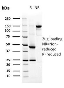 SDS-PAGE analysis of Anti-MSH6 Antibody [MSH6/2927] under non-reduced and reduced conditions; showing intact IgG and intact heavy and light chains, respectively. SDS-PAGE analysis confirms the integrity and purity of the antibody