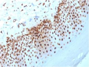 Anti-Nucleophosmin Mouse Monoclonal Antibody [clone: NPM1/3398]