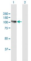 Anti-ADD2 Rabbit Polyclonal Antibody