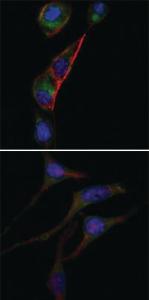 Anti-GOT2 Mouse Monoclonal Antibody [clone: 3E9]