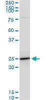 Anti-TPT1 Mouse Monoclonal Antibody [clone: 2A3]