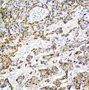 Anti-Peroxiredoxin 3 Rabbit Polyclonal Antibody