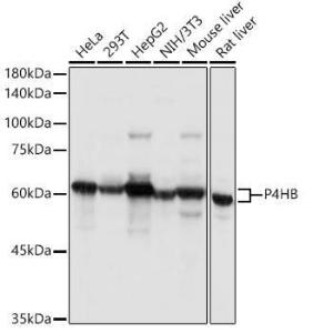 Western blot analysis of extracts of various cell lines, using Anti-P4HB Antibody (A8454) at 1:1000 dilution