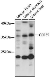 Western blot analysis of extracts of various cell lines, using Anti-GPCR GPR35 Antibody (A92891) at 1:1,000 dilution The secondary antibody was Goat Anti-Rabbit IgG H&L Antibody (HRP) at 1:10,000 dilution Lysates/proteins were present at 25 µg per lane